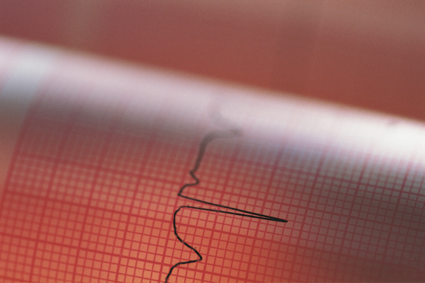 Failure to Attend Hospital for Heart and Stroke Problems Risk Worse Harm